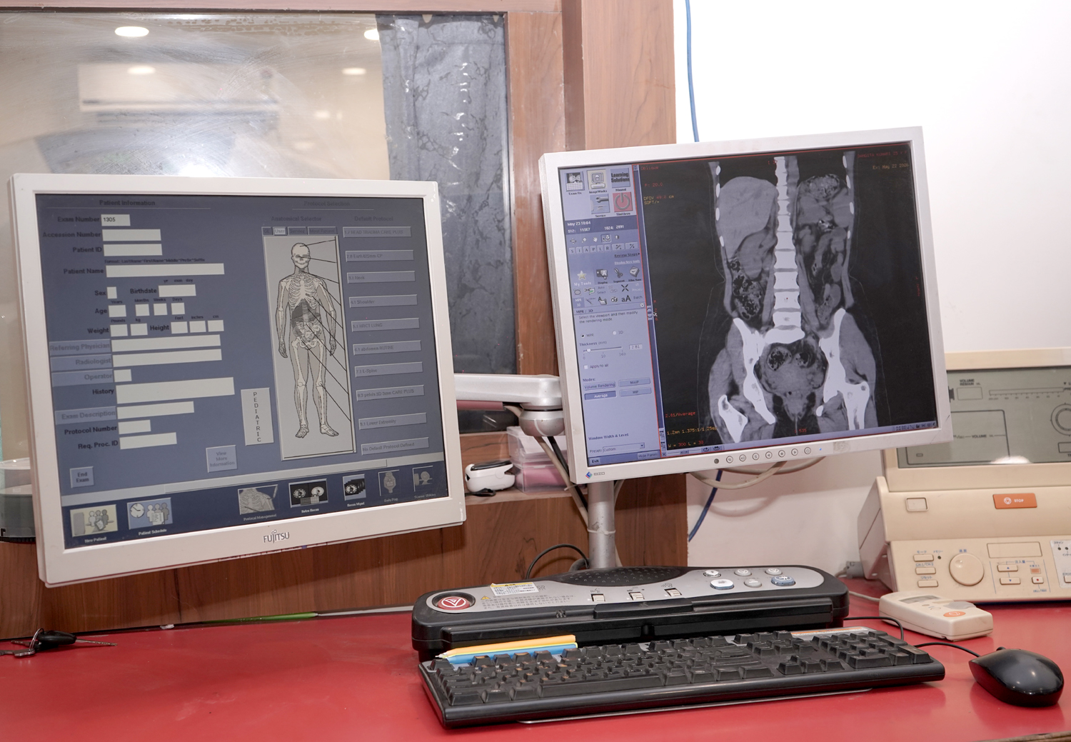 Mammography