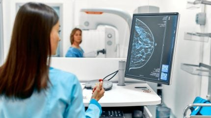Mammography